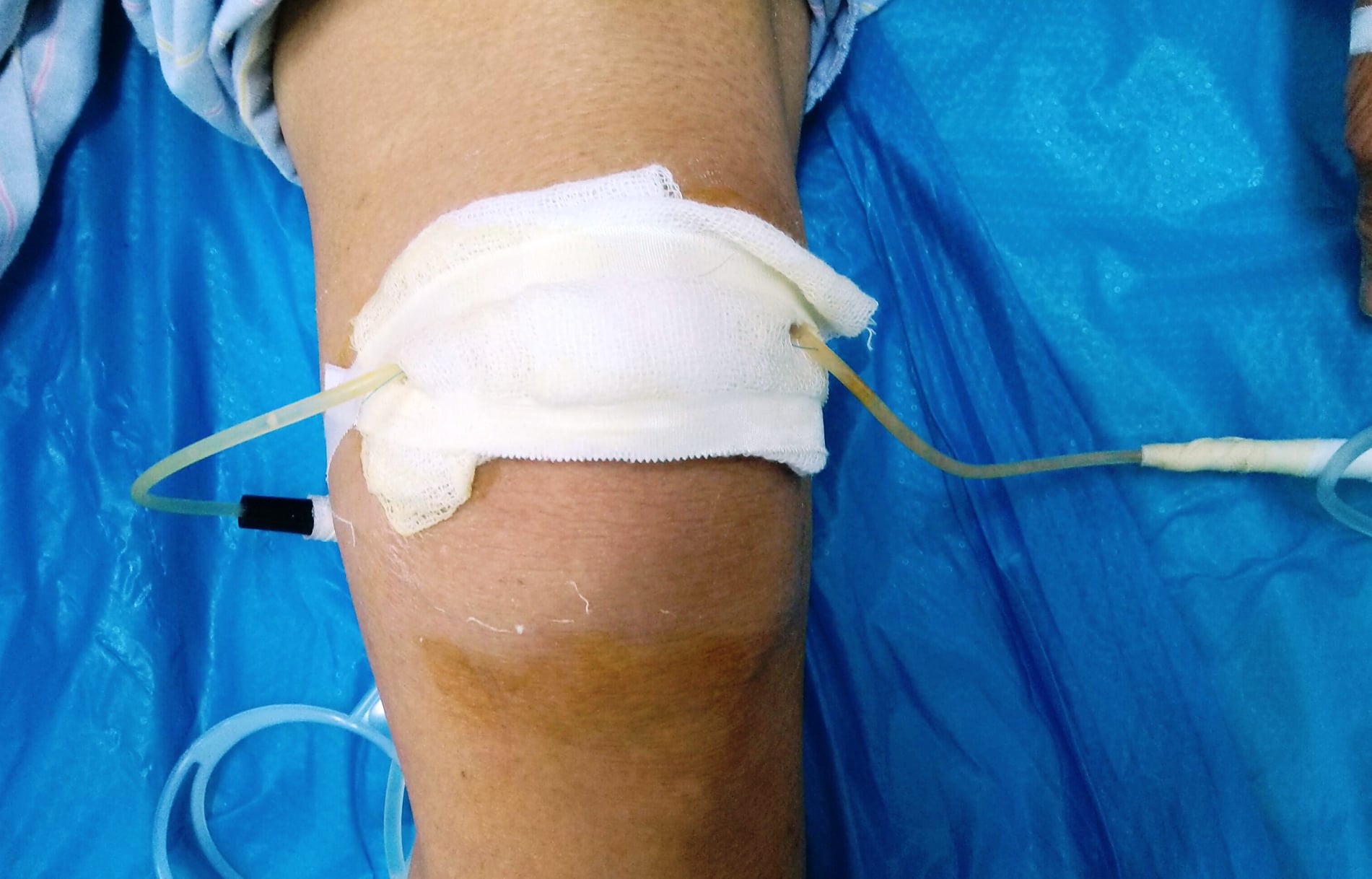 Sức khỏe của bạn: Bệnh khớp trong mùa lạnh – Bệnh viện đại học Y Khoa Vinh