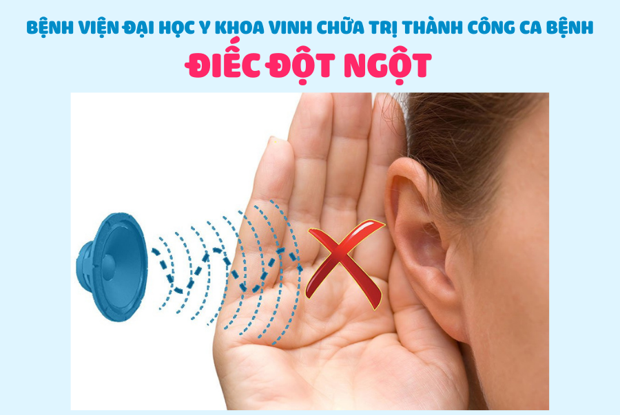 ĐIẾC ĐỘT NGỘT – BỆNH LÝ CẤP CỨU TRONG CHUYÊN KHOA TMH